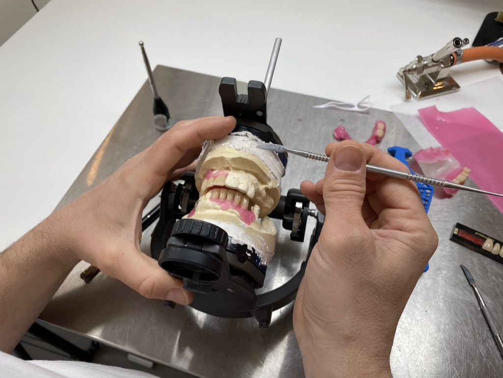 Ganium Klinisk Tandtekniker Tandopstilling 1