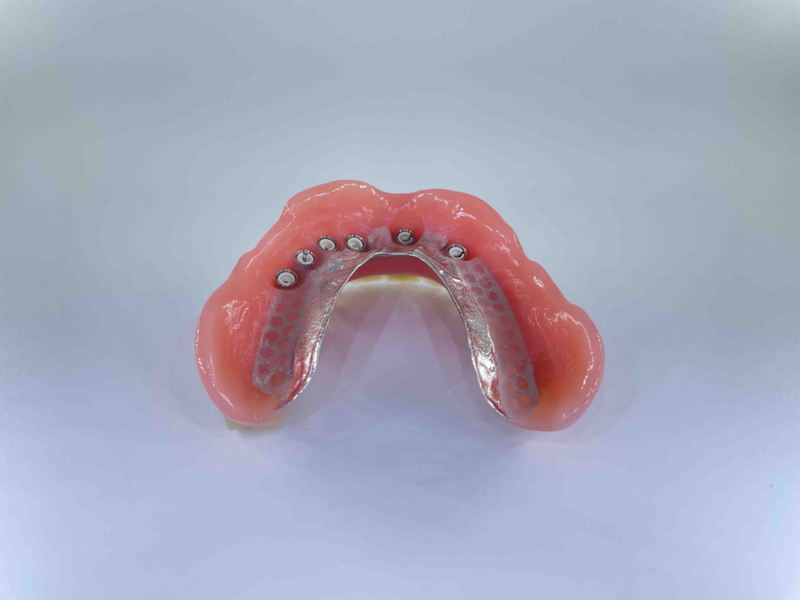 hybrid tandprotese til overmund bagfra Resultater af færdigeproduceret tandproteser