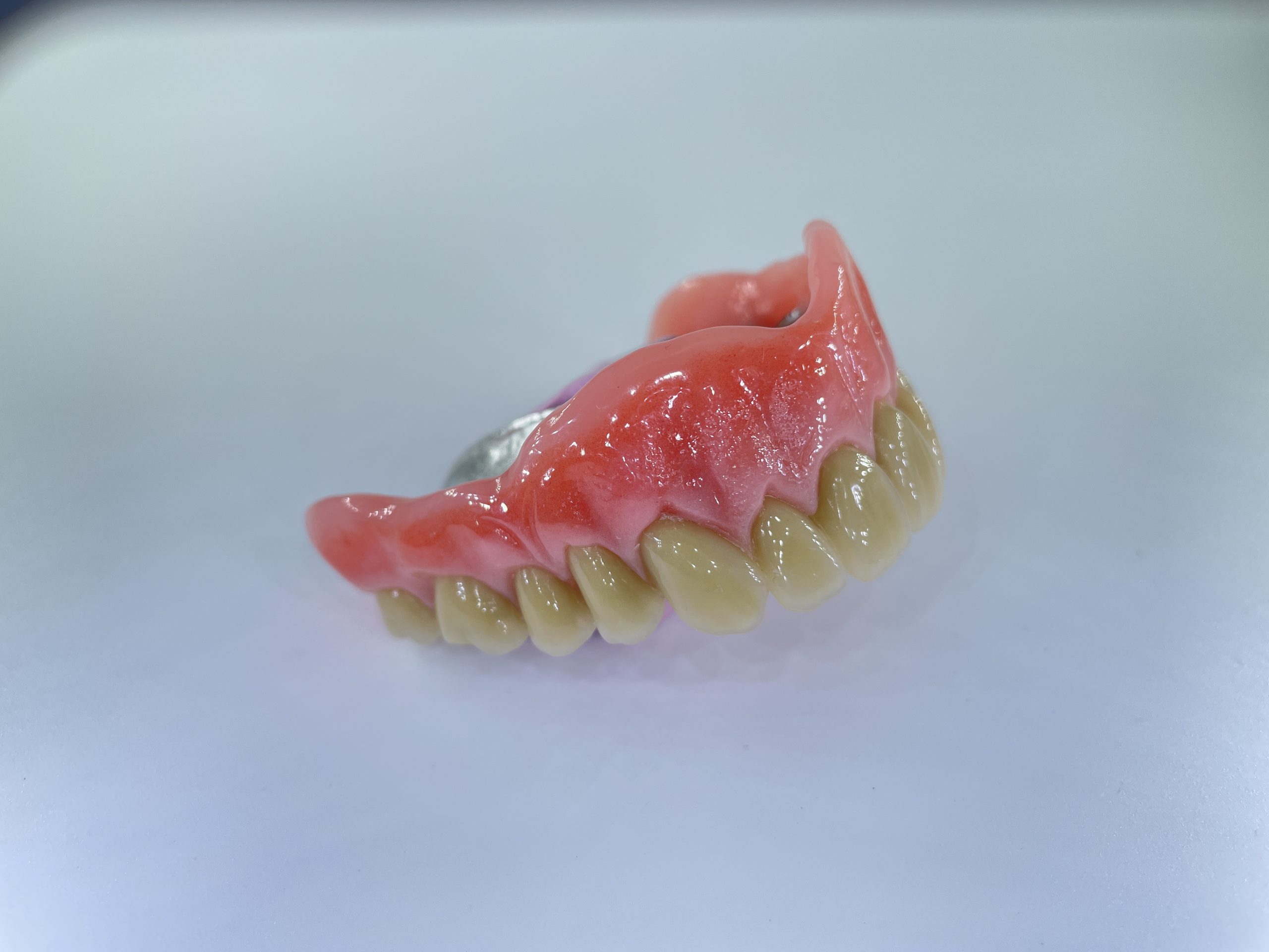 hybrid tandprotese til overmund højre Resultater af færdigeproduceret tandproteser