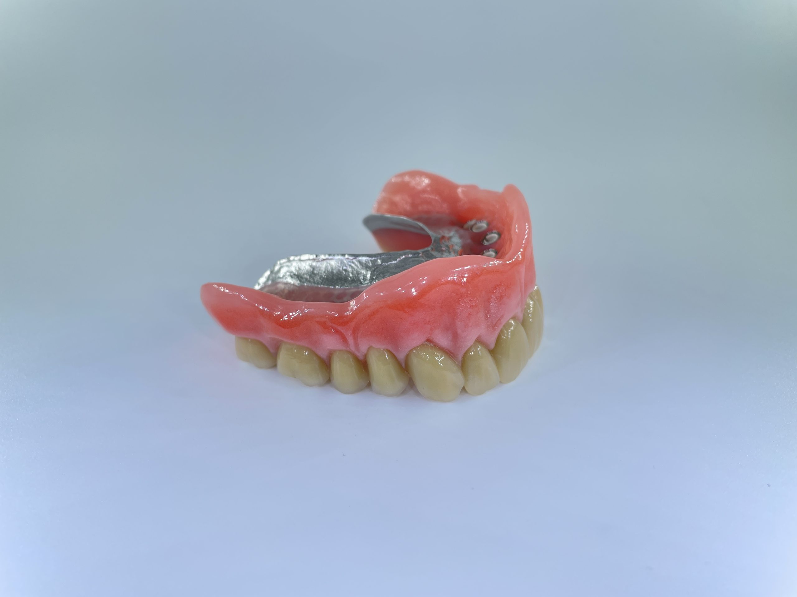 hybrid tandprotese til overmund højre tiltet Resultater af færdigeproduceret tandproteser