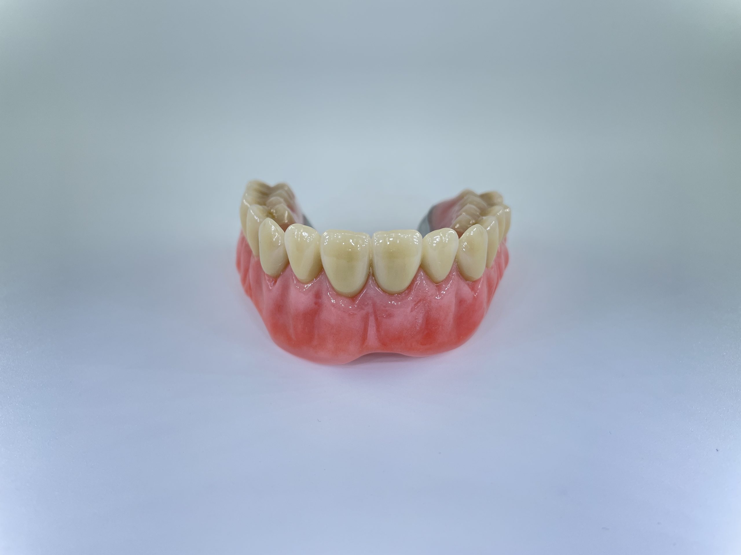 hybrid tandprotese til overmund omvendt foran Resultater af færdigeproduceret tandproteser