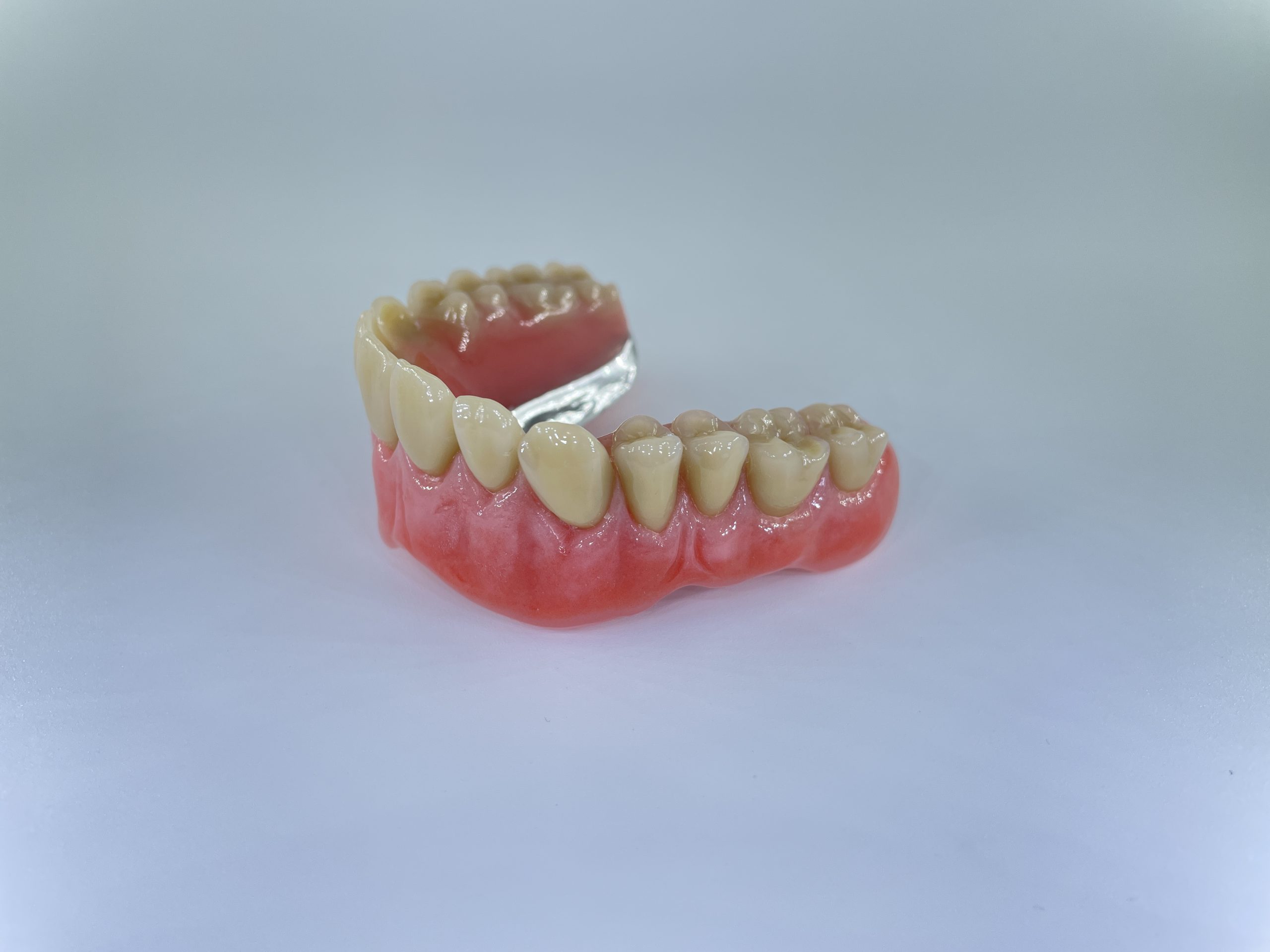 hybrid tandprotese til overmund omvendt højre Resultater af færdigeproduceret tandproteser