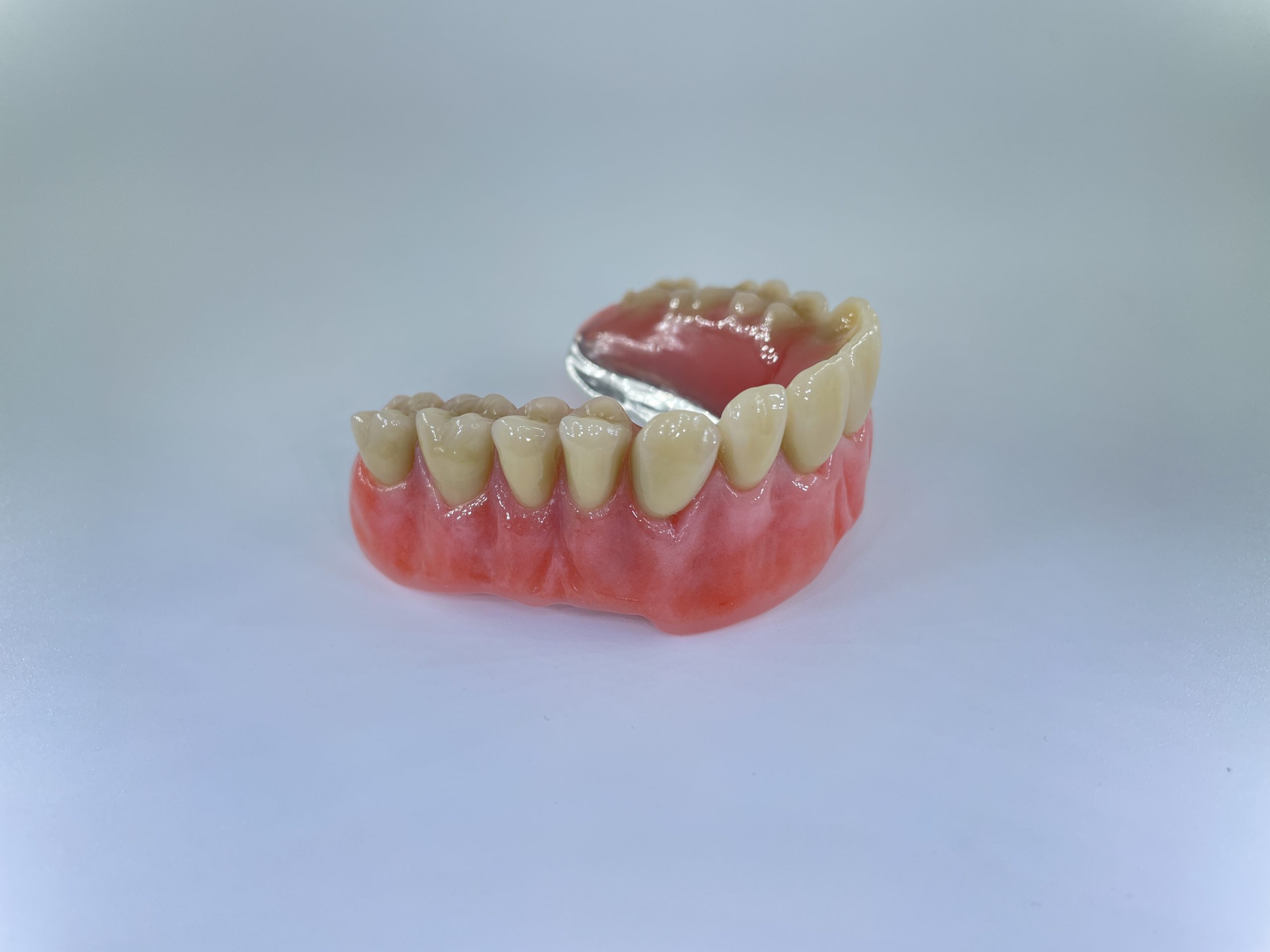 hybrid tandprotese til overmund omvendt Resultater af færdigeproduceret tandproteser venstre